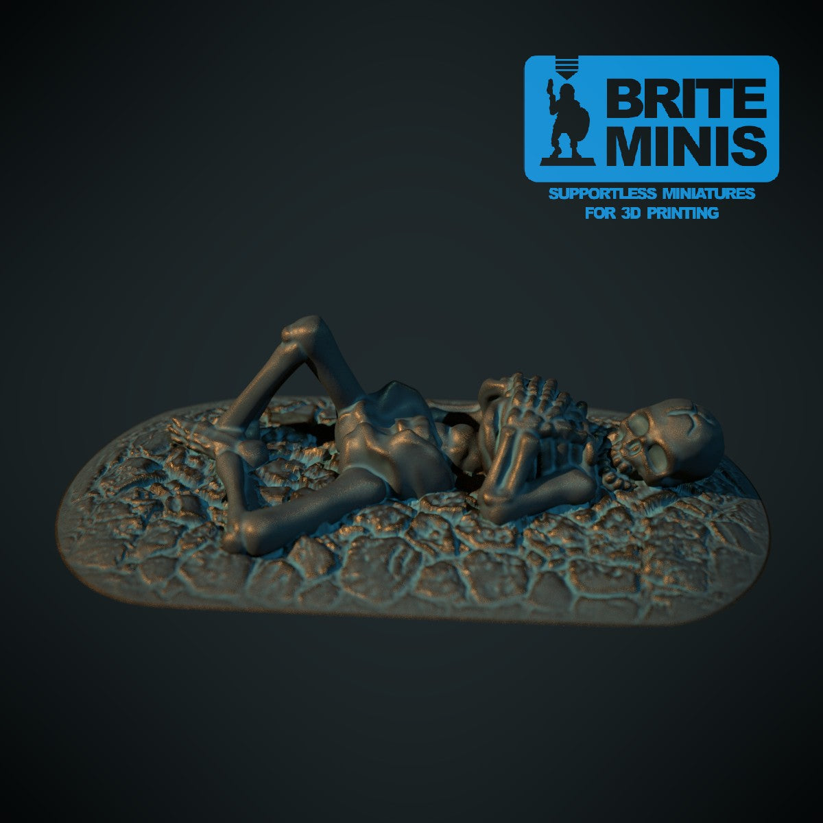 Skeleton remains